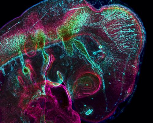 Side view of a 3-day-old chicken embryo, stained for proteins in the developing neurons and central nervous system.